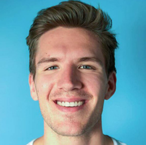 Invisalign Smile After